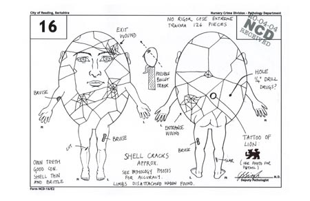 Mrs Singh's Egg Pathology Sketch (postcard)